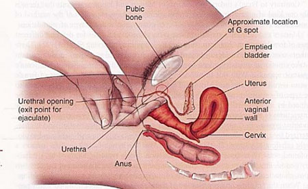 Co thắt âm đạo - Hình ảnh minh họa